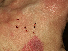 Small bed bugs on man's hand